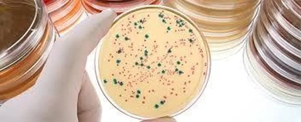 Análise De Água Microbiologia