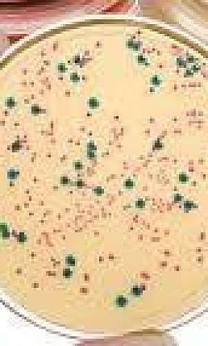 Análise de água microbiologia Análise de água microbiologia